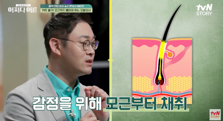 마약 검사할 때 뽑는 '머리카락 수', 상상초월이다